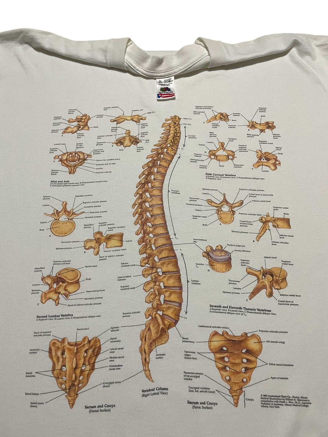 1992 Anatomical Chart Co. Spine Diagram Tee (XL)